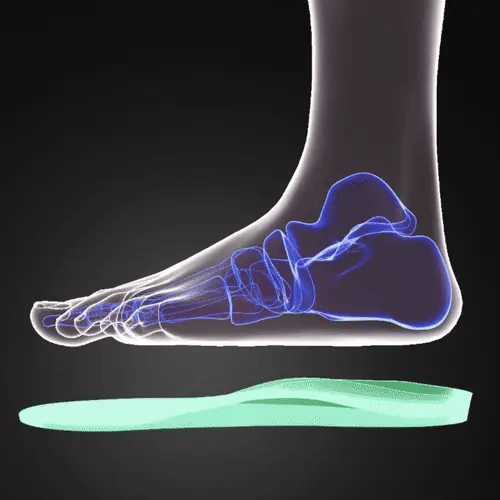 Supporto dell’arco plantare